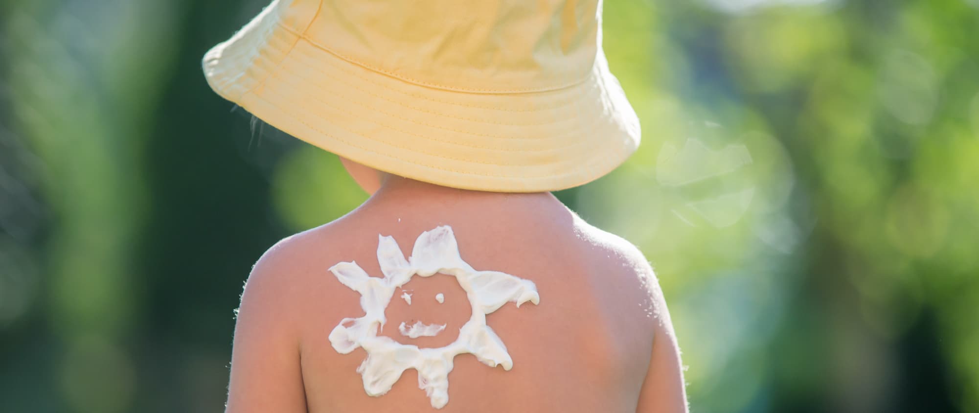 Comment traiter mon enfant brûlé par le soleil